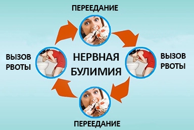 Лечение булимии в Олёкминске